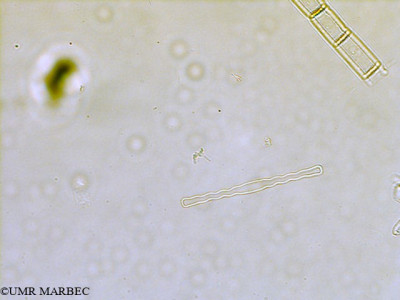 phyto/Scattered_Islands/all/COMMA April 2011/Toxarium sp (1)(copy)_thumb.jpg